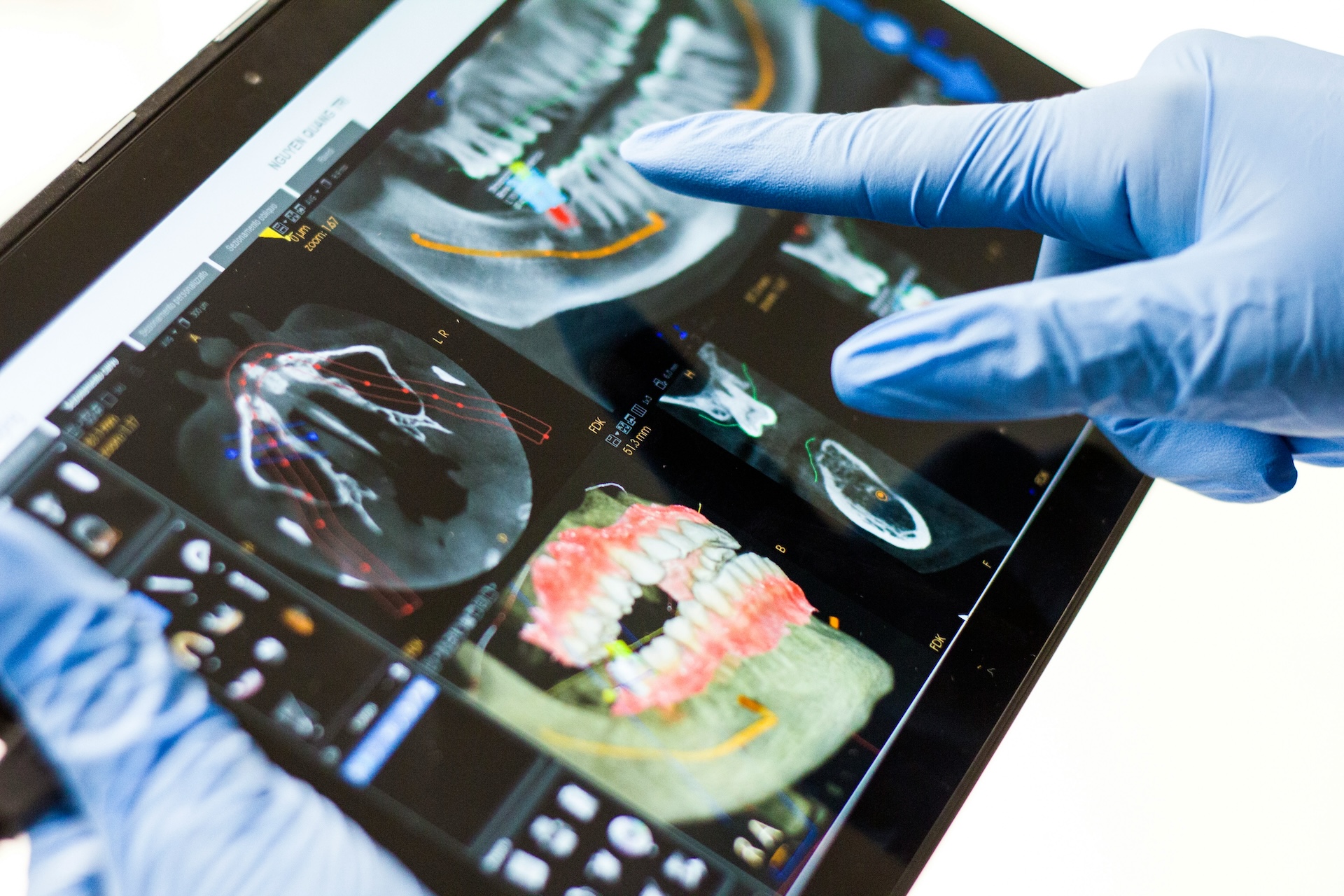 Edmonds dentist showing dental x-ray to patient